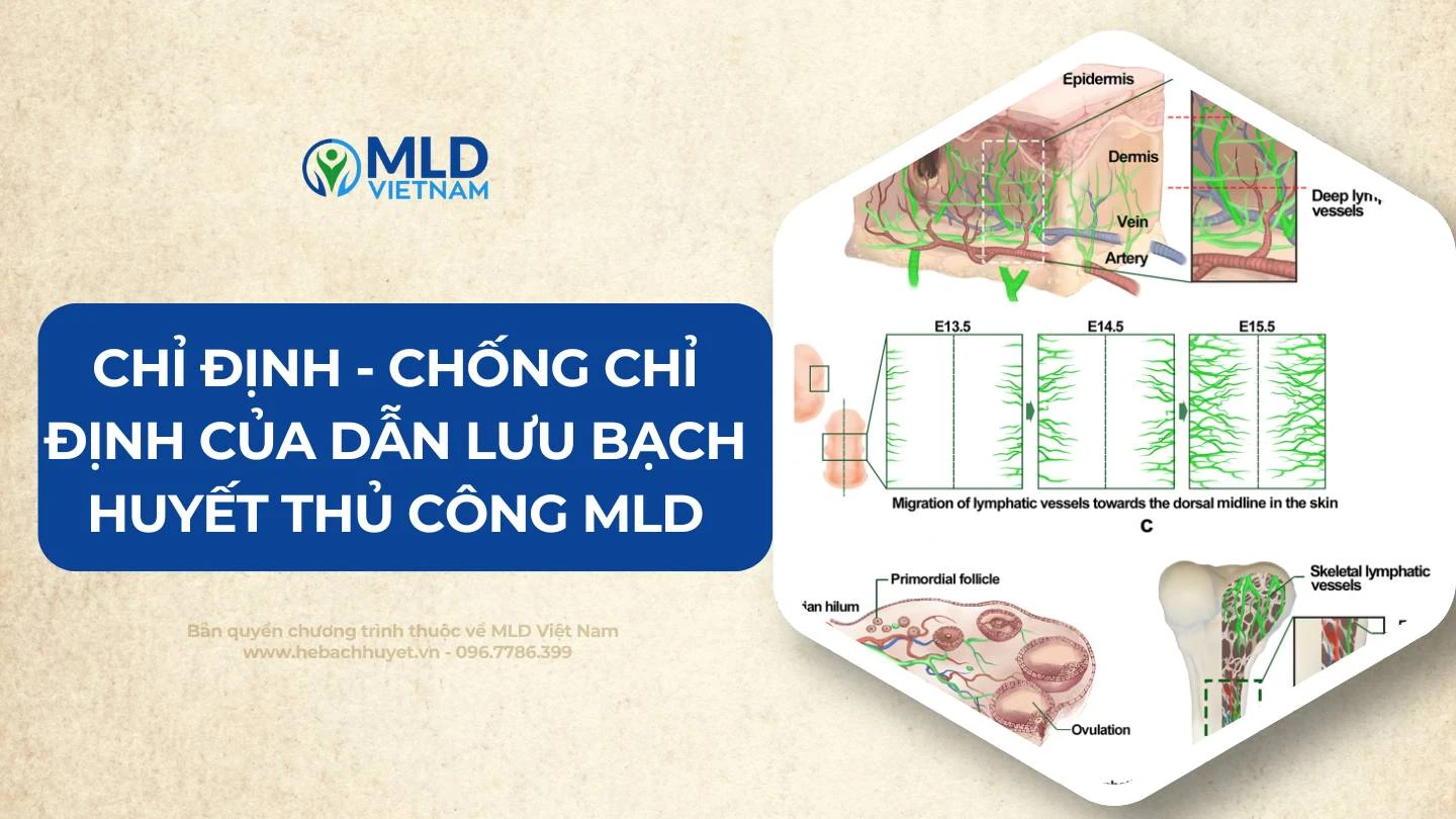 CHỐNG CHỈ ĐỊNH CỦA LIỆU PHÁP DẪN LƯU BẠCH HUYẾT (MLD/LDT)